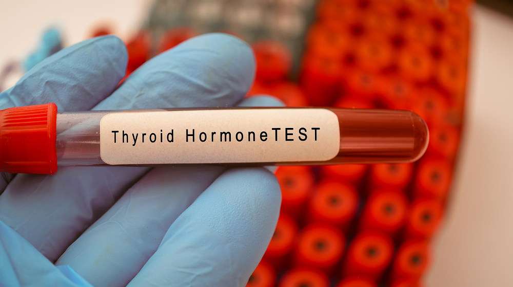 thyroid test, thyroid symptoms in tamil, தைராய்டு அறிகுறிகள்